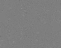 HCT 116 Cell Line human NOTE: Both the cell line and DNA from the cell line may be available for this product. Please choose -1VL or VIAL for cells, or -DNA-5UG for DNA, 91091005, human colon, Epithelial-like