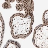 Anti-SIRT1 antibody produced in rabbit Prestige Antibodies® Powered by Atlas Antibodies, affinity isolated antibody, buffered aqueous glycerol solution