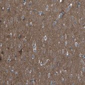 Anti-CMTM4 antibody produced in rabbit Prestige Antibodies® Powered by Atlas Antibodies, affinity isolated antibody, buffered aqueous glycerol solution