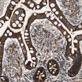 Anti-AKAP1 antibody produced in rabbit Prestige Antibodies® Powered by Atlas Antibodies, affinity isolated antibody, buffered aqueous glycerol solution