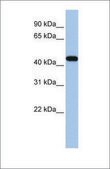 Anti-GATA3 antibody produced in rabbit affinity isolated antibody