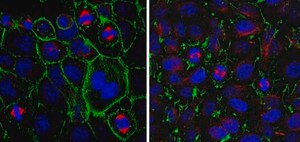Anti-PPAR-gamma Antibody from rabbit, purified by affinity chromatography