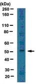 Anti-LMX-1 Antibody serum, from rabbit