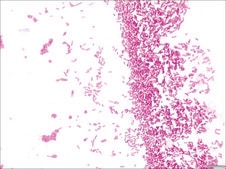 Crystal Violet Solution