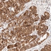 Anti-DTNBP1 antibody produced in rabbit Prestige Antibodies® Powered by Atlas Antibodies, affinity isolated antibody, buffered aqueous glycerol solution, ab3
