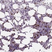 Anti-MMP9 antibody produced in rabbit affinity isolated antibody, buffered aqueous glycerol solution