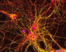 Anti-Rabbit IgG (whole molecule)–TRITC antibody produced in goat affinity isolated antibody, buffered aqueous solution