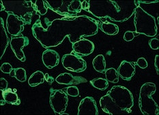 Monoclonal Anti-Cytokeratin, pan−FITC antibody produced in mouse clone C-11, purified immunoglobulin, buffered aqueous solution