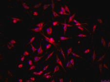 OSUMMER.2 Mouse NRAS-Mutant Melanoma Cell Line