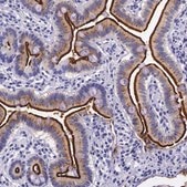 Anti-ACE2 antibody produced in rabbit Prestige Antibodies® Powered by Atlas Antibodies, affinity isolated antibody, buffered aqueous glycerol solution