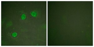 Anti-GATA3 antibody produced in rabbit affinity isolated antibody
