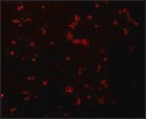 Anti-RIPK1 antibody produced in rabbit affinity isolated antibody, buffered aqueous solution