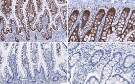 Anti-E-Cadherin Antibody serum, Upstate®