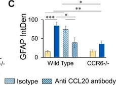 Anti-Glial Fibrillary Acidic Protein Antibody Chemicon®, from chicken