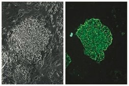 Anti-Stage-Specific Embryonic Antigen-4 Antibody, clone MC-813-70 clone MC-813-70, Chemicon®, from mouse