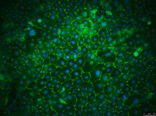 16HBE14o- Human Bronchial Epithelial Cell Line 16HBE14o- human bronchial epithelial cell line is widely used to model barrier function of the airway epithelium and to study respiratory ion transport as well as the function of CFTR.