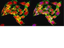 Anti-Ubiquitin Antibody, Lys48-Specific, clone Apu2, rabbit monoclonal clone Apu2, from rabbit