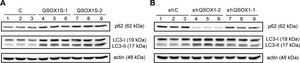 Anti-LC3 antibody produced in rabbit ~1 mg/mL, affinity isolated antibody, buffered aqueous solution