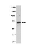 Anti-p67-phox (mouse) Antibody Upstate®, from rabbit