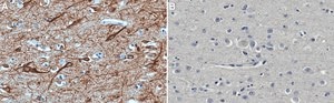 Anti-MAP2 Antibody, clone 5F9 clone 5F9, Upstate®, from mouse