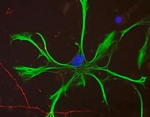 Anti-Neurofilament H Antibody Chemicon®, from chicken