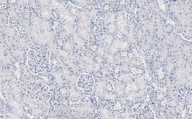 Anti-Nestin Antibody, clone 10C2 ZooMAb® Mouse Monoclonal recombinant, expressed in HEK 293 cells
