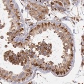 Anti-RNF139 antibody produced in rabbit Prestige Antibodies® Powered by Atlas Antibodies, affinity isolated antibody, buffered aqueous glycerol solution