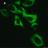 抗EGFR抗体 クローン11E19 ZooMAb®ウサギモノクローナル recombinant, expressed in HEK 293 cells