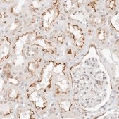 Anti-GNAS antibody produced in rabbit Prestige Antibodies® Powered by Atlas Antibodies, affinity isolated antibody, buffered aqueous glycerol solution, ab1