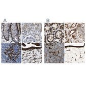 抗RRBP1抗体 ウサギ宿主抗体 Prestige Antibodies® Powered by Atlas Antibodies, affinity isolated antibody, buffered aqueous glycerol solution