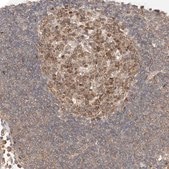 抗-MKL1 ウサギ宿主抗体 Prestige Antibodies® Powered by Atlas Antibodies, affinity isolated antibody, buffered aqueous glycerol solution
