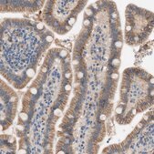 Anti-FDFT1 antibody produced in rabbit affinity isolated antibody, buffered aqueous glycerol solution