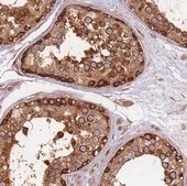 Anti-DYNC1I2 antibody produced in rabbit Prestige Antibodies® Powered by Atlas Antibodies, affinity isolated antibody, buffered aqueous glycerol solution