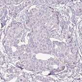 Monoclonal Anti-HER2 antibody produced in mouse Prestige Antibodies® Powered by Atlas Antibodies, clone CL0268, purified immunoglobulin, buffered aqueous glycerol solution