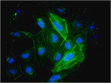 LX-2 Human Hepatic Stellate Cell Line a highly suitable model of human hepatic fibrosis
