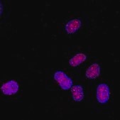 Anti-monomethyl-Histone H3 (Lys4) Antibody Upstate®, from rabbit