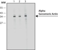 Anti-Actin (α-Sarcomeric) antibody, Mouse monoclonal clone 5C5, hybridoma cell culture supernatant