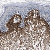 Anti-POSTN antibody produced in rabbit Prestige Antibodies® Powered by Atlas Antibodies, affinity isolated antibody, buffered aqueous glycerol solution