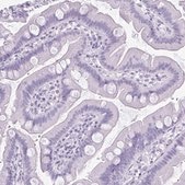 Anti-KRT5 antibody produced in rabbit Prestige Antibodies® Powered by Atlas Antibodies, affinity isolated antibody, buffered aqueous glycerol solution
