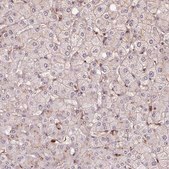 Anti-CHMP4B antibody produced in rabbit Prestige Antibodies® Powered by Atlas Antibodies, affinity isolated antibody, buffered aqueous glycerol solution