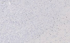 Anti-Tyrosine Hydroxylase Antibody, clone 2/40/15 ZooMAb® Mouse Monoclonal recombinant, expressed in HEK 293 cells