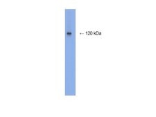 Anti-NMDAR1 Antibody, rabbit monoclonal culture supernatant, clone 1.17.2.6, Chemicon®