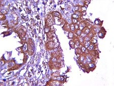 Anticuerpo anti-VEGF from rabbit, purified by affinity chromatography