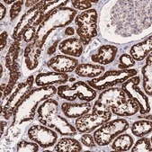 Anti-GSTM1 antibody produced in rabbit Prestige Antibodies® Powered by Atlas Antibodies, affinity isolated antibody, buffered aqueous glycerol solution