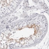 Anti-DNALI1 antibody produced in rabbit Prestige Antibodies® Powered by Atlas Antibodies, affinity isolated antibody, buffered aqueous glycerol solution