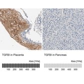 Anti-TGFBI antibody produced in rabbit Prestige Antibodies® Powered by Atlas Antibodies, affinity isolated antibody, buffered aqueous glycerol solution