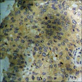 Anti-phospho-AMPK α (pThr172) antibody produced in rabbit affinity isolated antibody