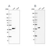Anti-ARG1 antibody produced in rabbit Prestige Antibodies® Powered by Atlas Antibodies, affinity isolated antibody, buffered aqueous glycerol solution