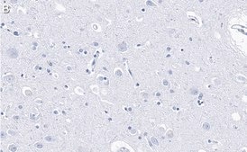 Anti-PSD-95 Antibody, clone 2B20 ZooMAb® Rabbit Monoclonal recombinant, expressed in HEK 293 cells