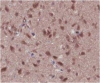 Anti-GABA Antibody from rabbit, purified by affinity chromatography
